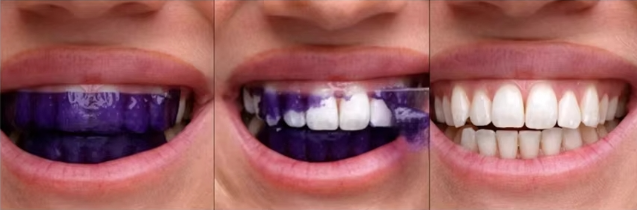 Strips Blanchissantes Violettes — Bylume